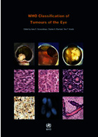 WHO Classification of Tumours of the Eye, 4th Edition2018 طبقه بندی تومورهای چشم